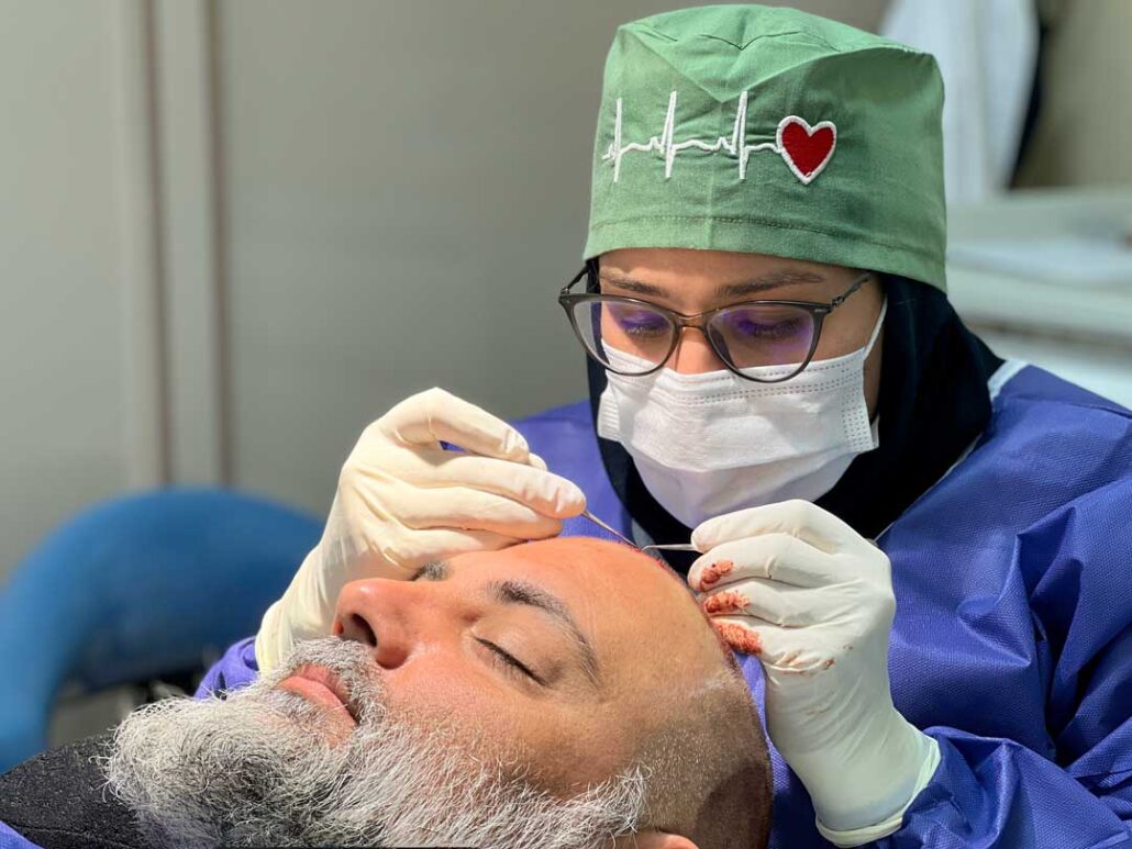تکنسین کاشت چه کسی است ، تکنسین چه ویژگی هایی دارد
