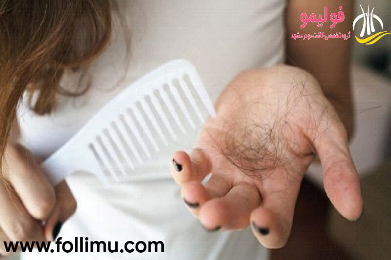 ریزش مو و افسردگی و استرس