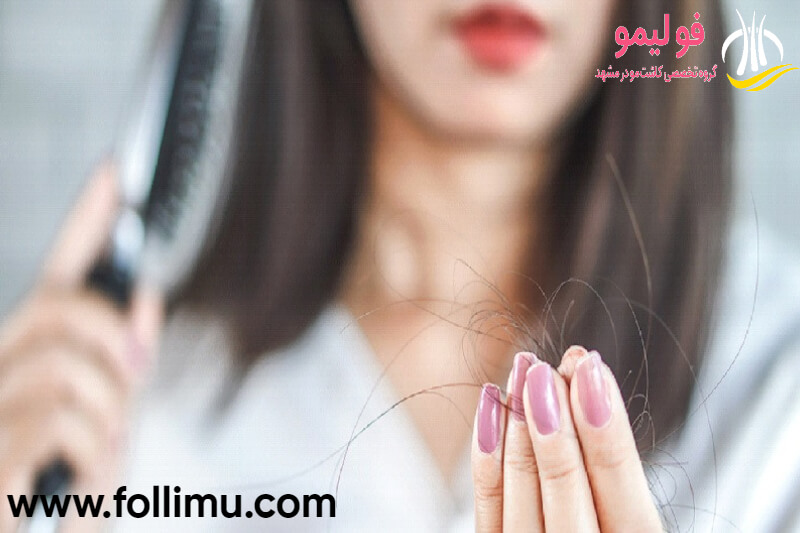 ریزش 50 تا 100 تار مو در روز طبیعی است