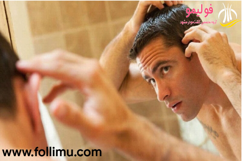 ارتباط ریزش مو و افسردگی و استرس