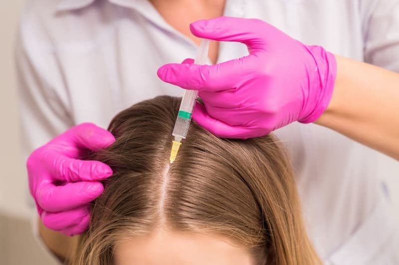 هزینه مزوتراپی مو چقدر است؟