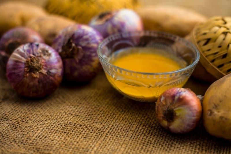 آب پیاز برای ریزش مو