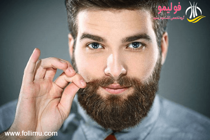 کاشت ریش و سیبیل