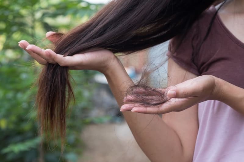تأثیر زایمان، بیماری یا سایر عوامل استرس زا بر ریزش ناگهانی مو