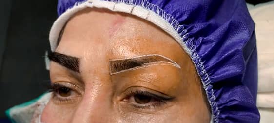 کاشت ابرو یک روش دائمی برای تغییر وضعیت ابروها طبق سلیقه خود فرد