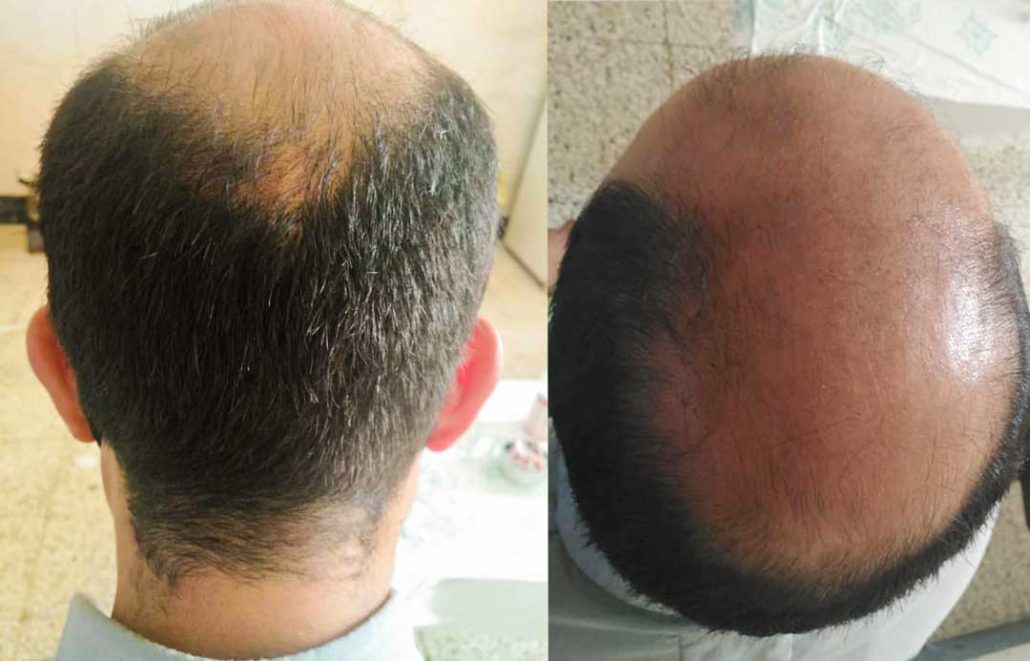 بررسی تمام علائم حیاتی بدن و وضعیت ظاهری سر