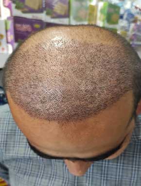 بعد از یک هفته کاشتمو