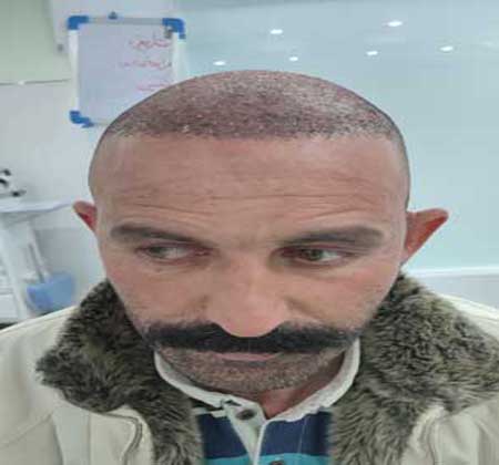 بعد از 1 ماه کاشت