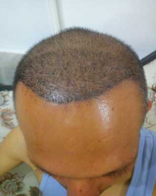 بعد از 1 ماه کاشت