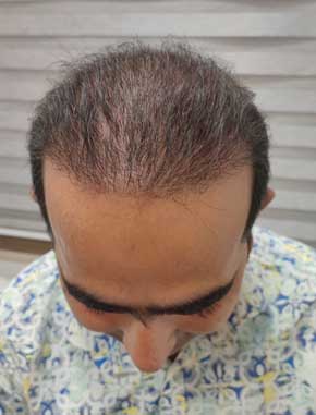 بعد از 3 ماه کاشت