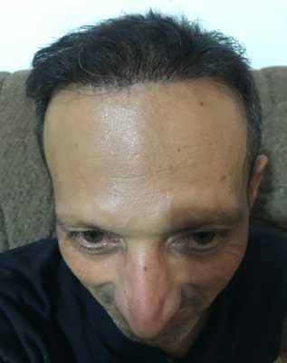 کاشت پرتراکم ، کاشتمو