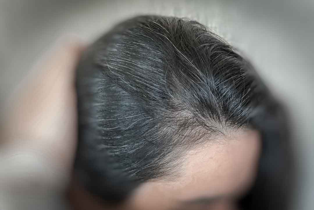 شخص دچار پیری زود رس مو سر